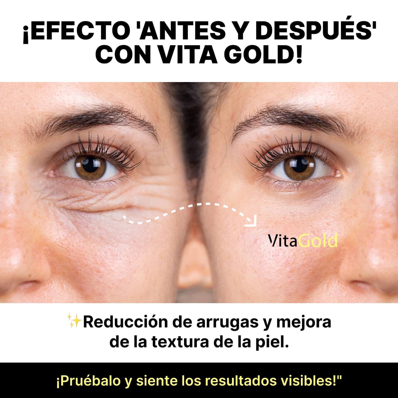 Vitagold - 20 AÑOS MENOS EN 5 MINUTOS