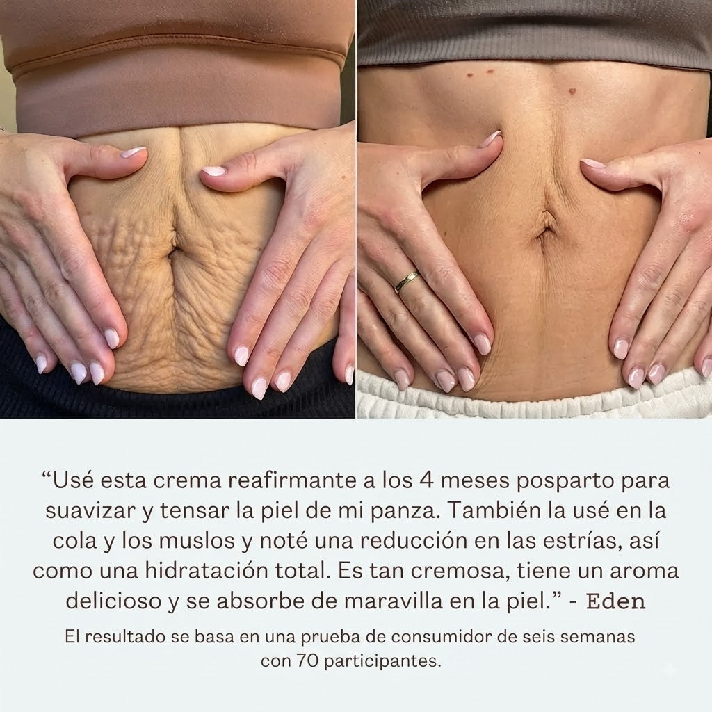 Crema Control Celulítico – Piel Más Firme, Suave y Visiblemente Uniforme