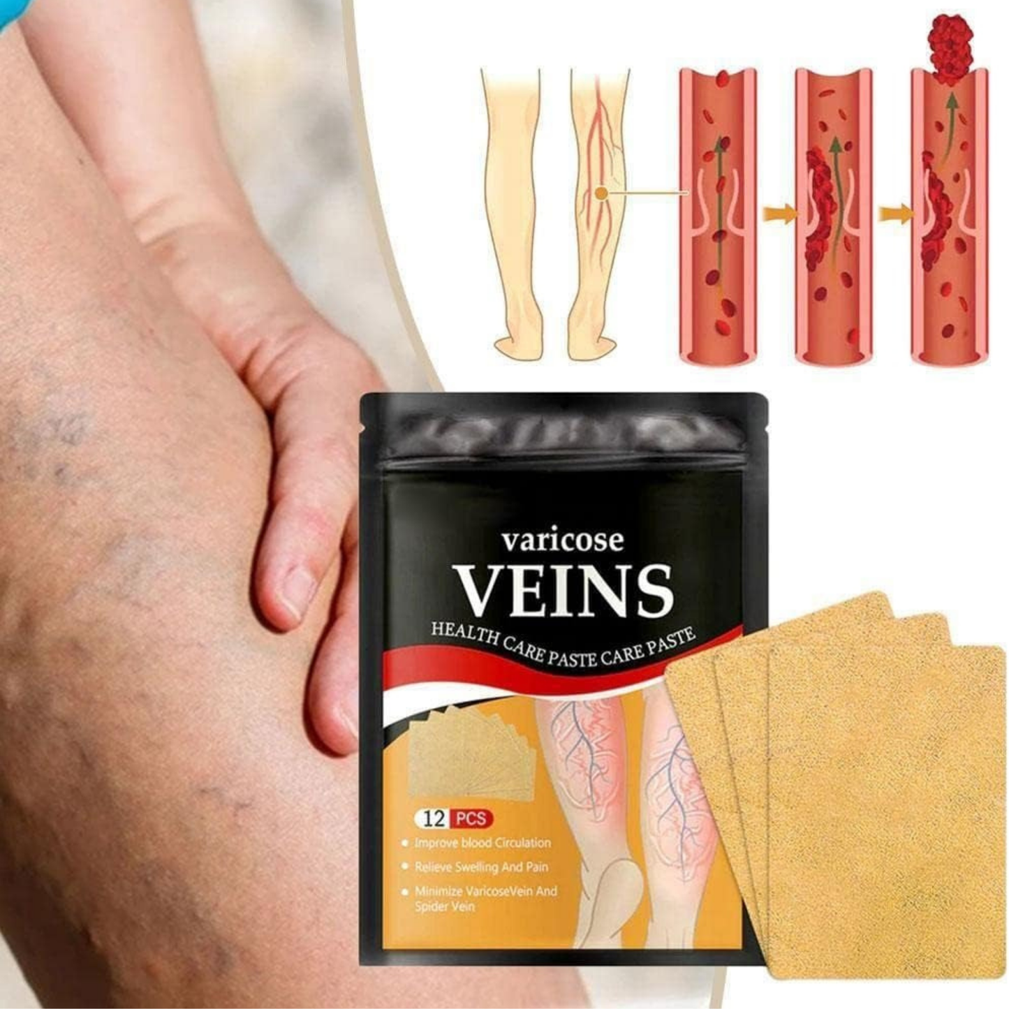 Parche Antivarices – Alivio Natural para Piernas Ligeras y Saludables