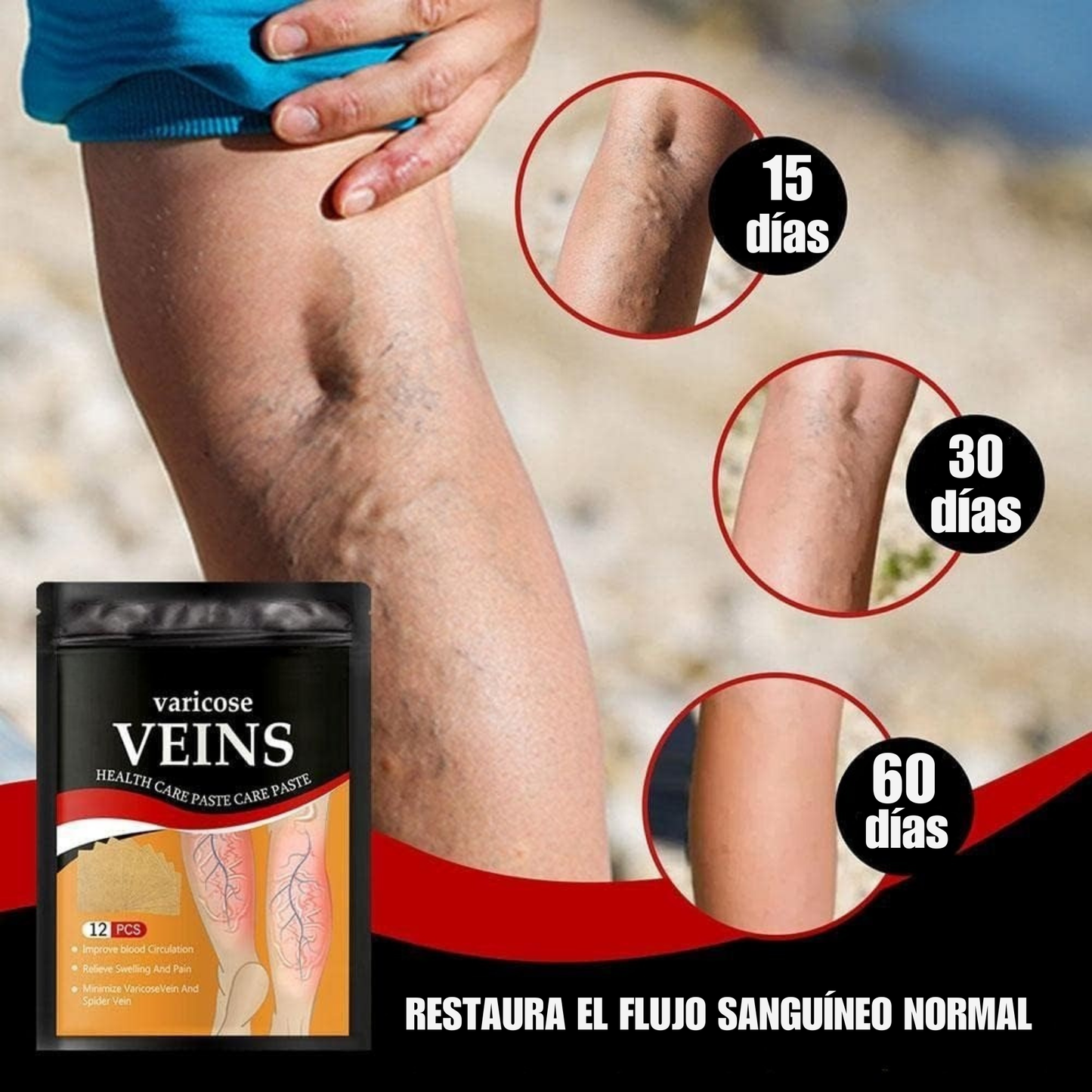 Parche Antivarices – Alivio Natural para Piernas Ligeras y Saludables