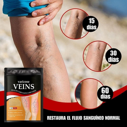 Parche Antivarices – Alivio Natural para Piernas Ligeras y Saludables