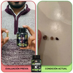 Stone Dissolver+ – Suplemento Natural para Eliminar Cálculos Renales y Proteger la Salud Urinaria