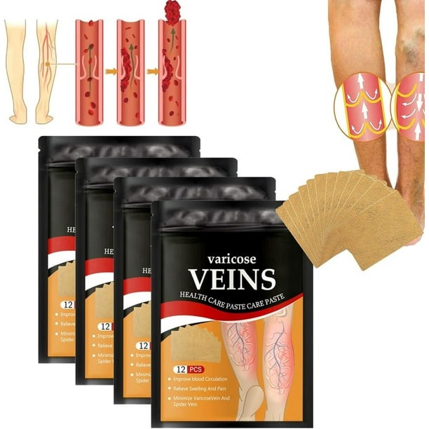Parche Antivarices – Alivio Natural para Piernas Ligeras y Saludables