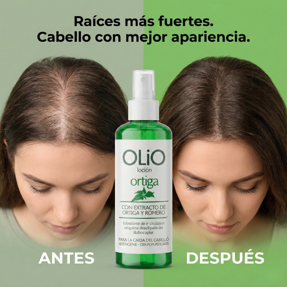 Olio Loción Ortiga