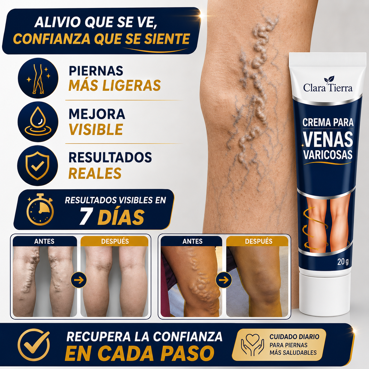 Crema para las Varices - Siente Tus Piernas Más Ligeras, Frescas y Cómodas Cada Día (Oferta 2x1)