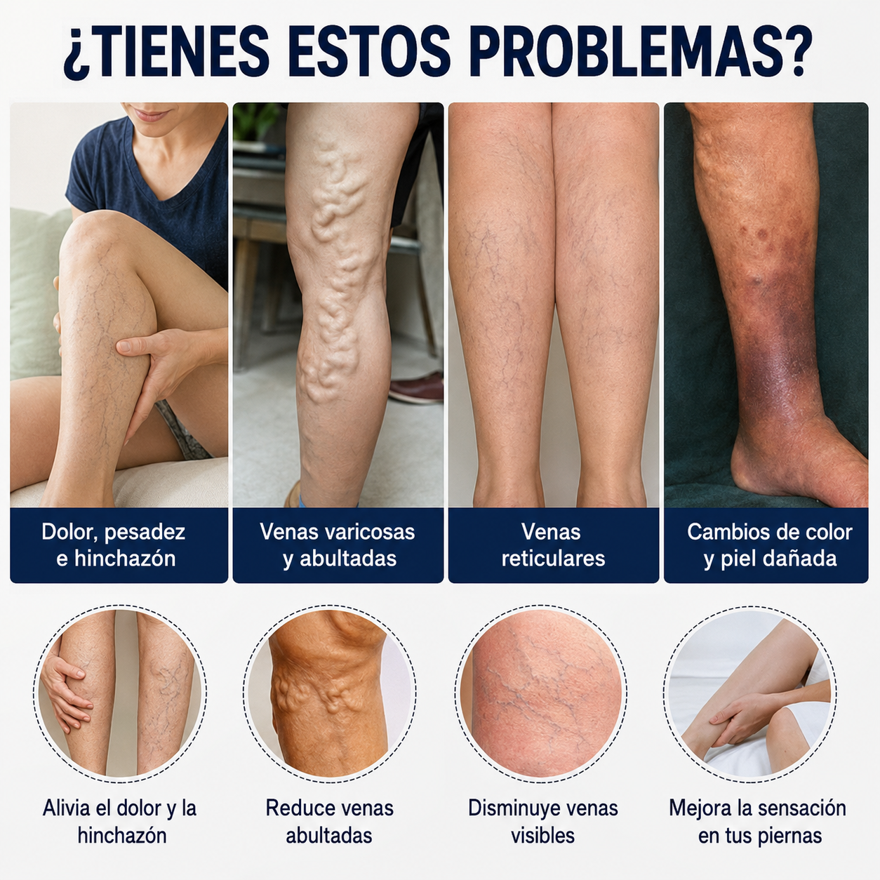 Crema para las Varices - Siente Tus Piernas Más Ligeras, Frescas y Cómodas Cada Día (Oferta 2x1)