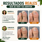 7Dias Tratamiento para Uñas – Uñas Más Fuertes, Saludables y Radiantes Desde la Primera Aplicación