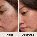 LumiFirm™ Serum Mágico de Juventud – Firmeza y Brillo Instantáneos