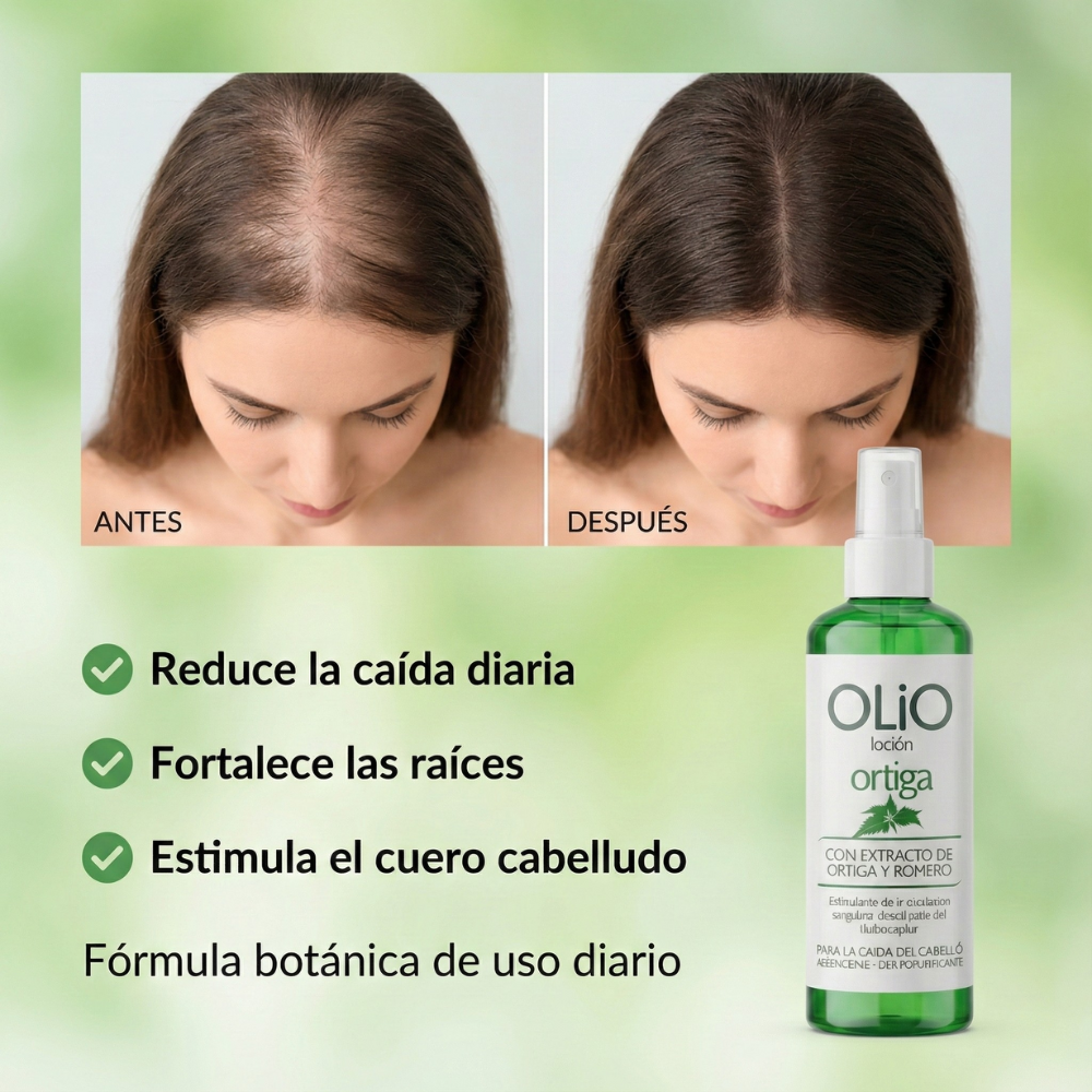 Olio Loción Ortiga