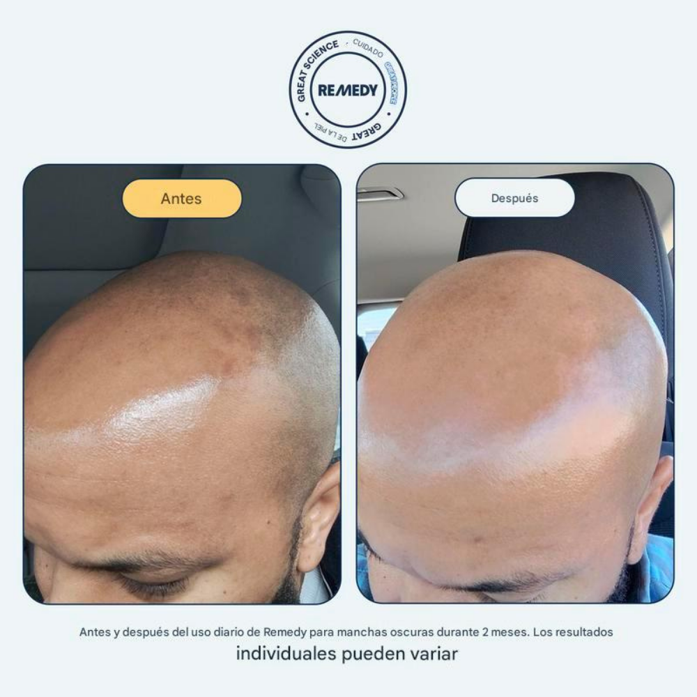 BrilloClaro - Sérum Renovador Facial