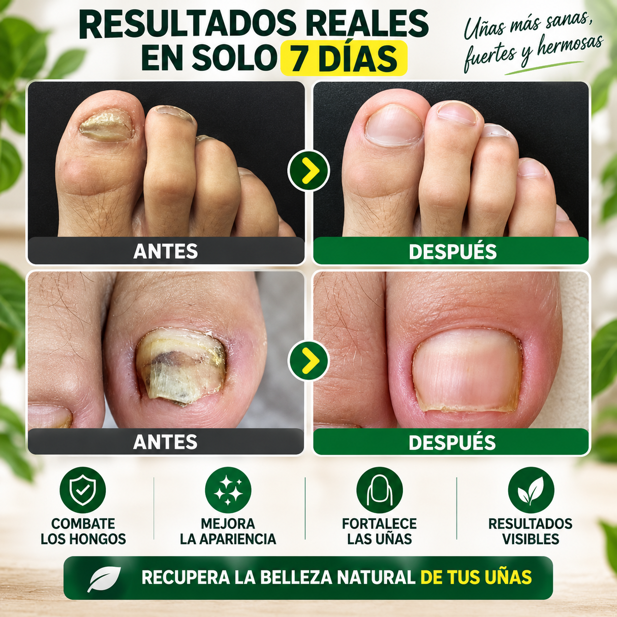 Tratamiento Antihongos 7 Días – Fórmula 100% Natural para Uñas Más Sanas y Fuertes