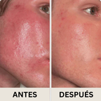 LumiFirm™ Serum Mágico de Juventud – Firmeza y Brillo Instantáneos