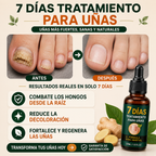 7Dias Tratamiento para Uñas – Uñas Más Fuertes, Saludables y Radiantes Desde la Primera Aplicación