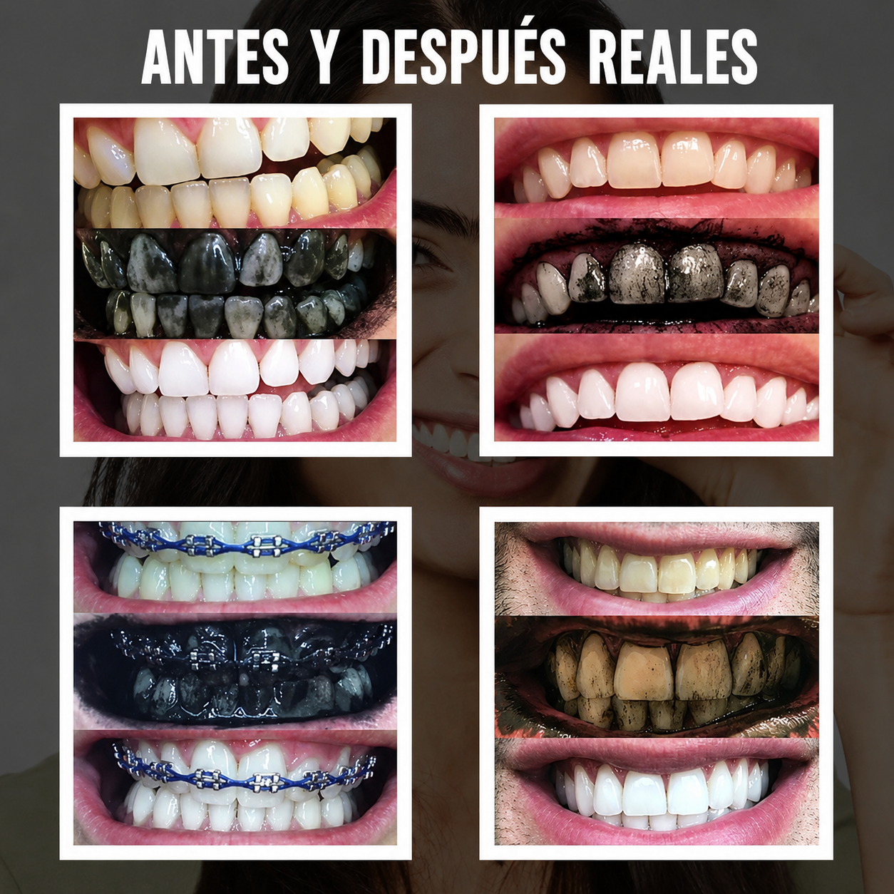 Polvo Dental Brillo — Volvé a sonreír con confianza y dejá que tu sonrisa hable por vos