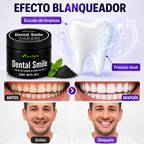 Polvo Dental Smile - una sonrisa más blanca, fresca y segura desde casa