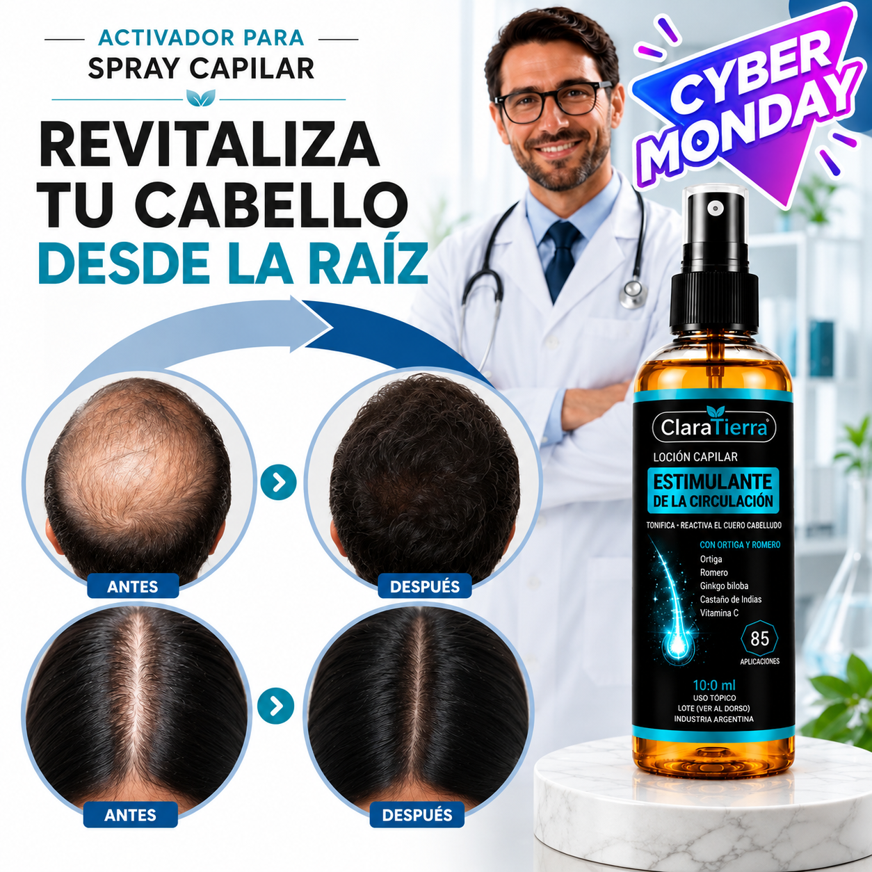 Activador para Spray Capilar – Cabello Más Fuerte, Denso y Saludable Desde la Raíz-1