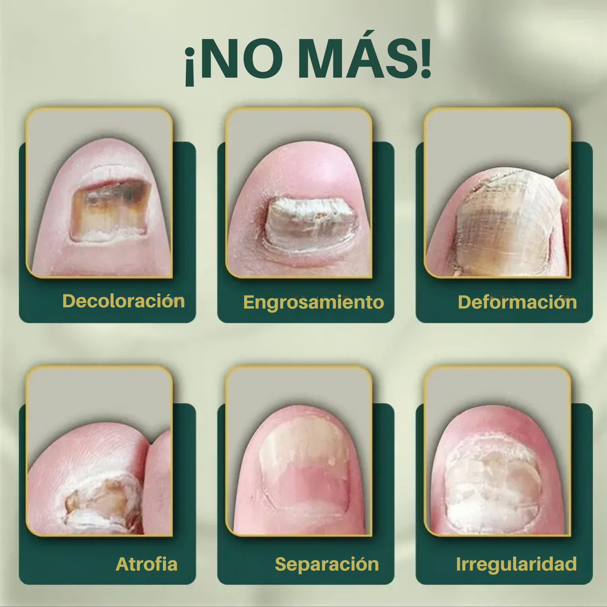 Uñas Libres de Hongos en 7 Días – Tratamiento Natural y Efectivo