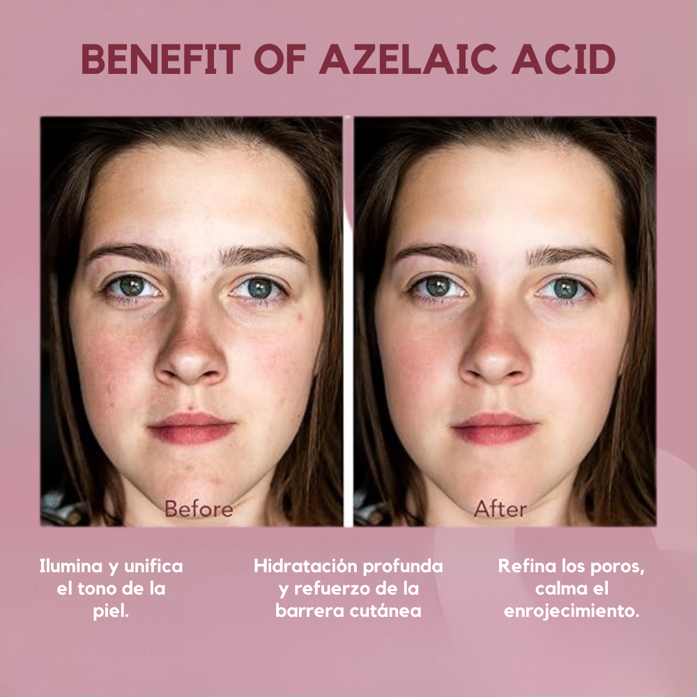 Febble – Crema Renovadora de Brillo Eterno