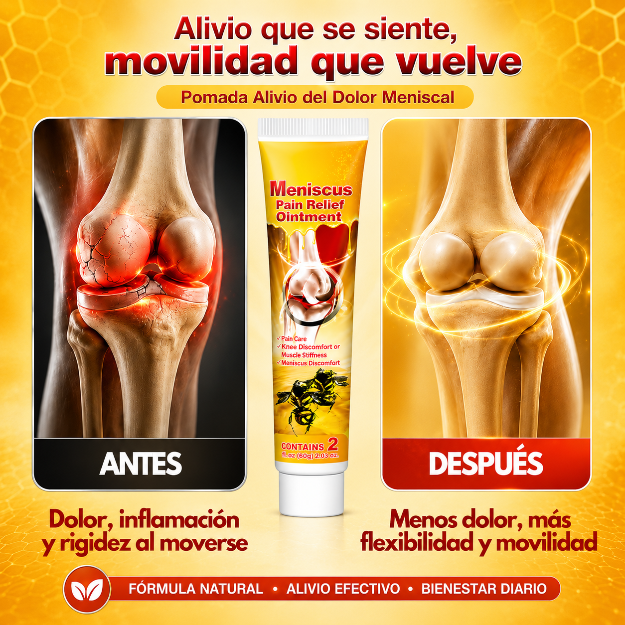 Crema Para Meniscos - Por Fin Movete Sin Dolor Constante En Las Articulaciones
