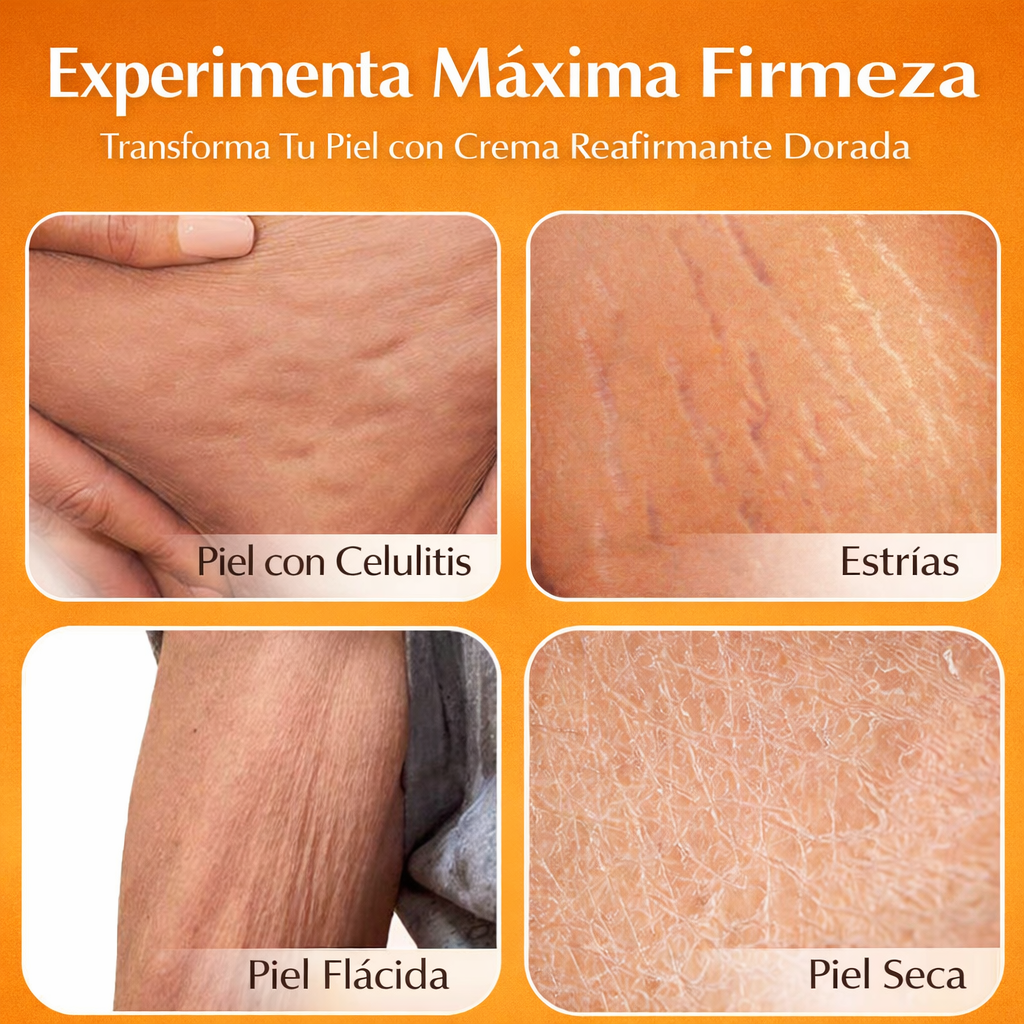 GOICOECHEA Anticelulitis - Piel más lisa y firme que realmente se ve