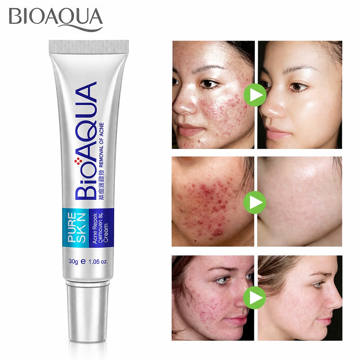 Bioaqua Anti Acne Cream – Control de Grasa • Reducción de Poros • Reparación de Marcas