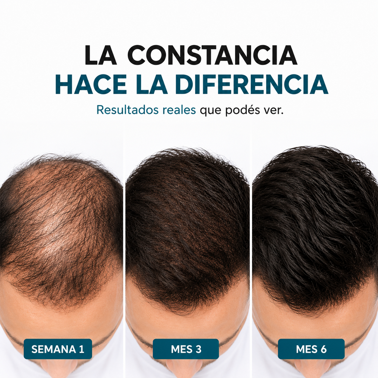 Activador para Spray Capilar – Cabello Más Fuerte, Denso y Saludable Desde la Raíz