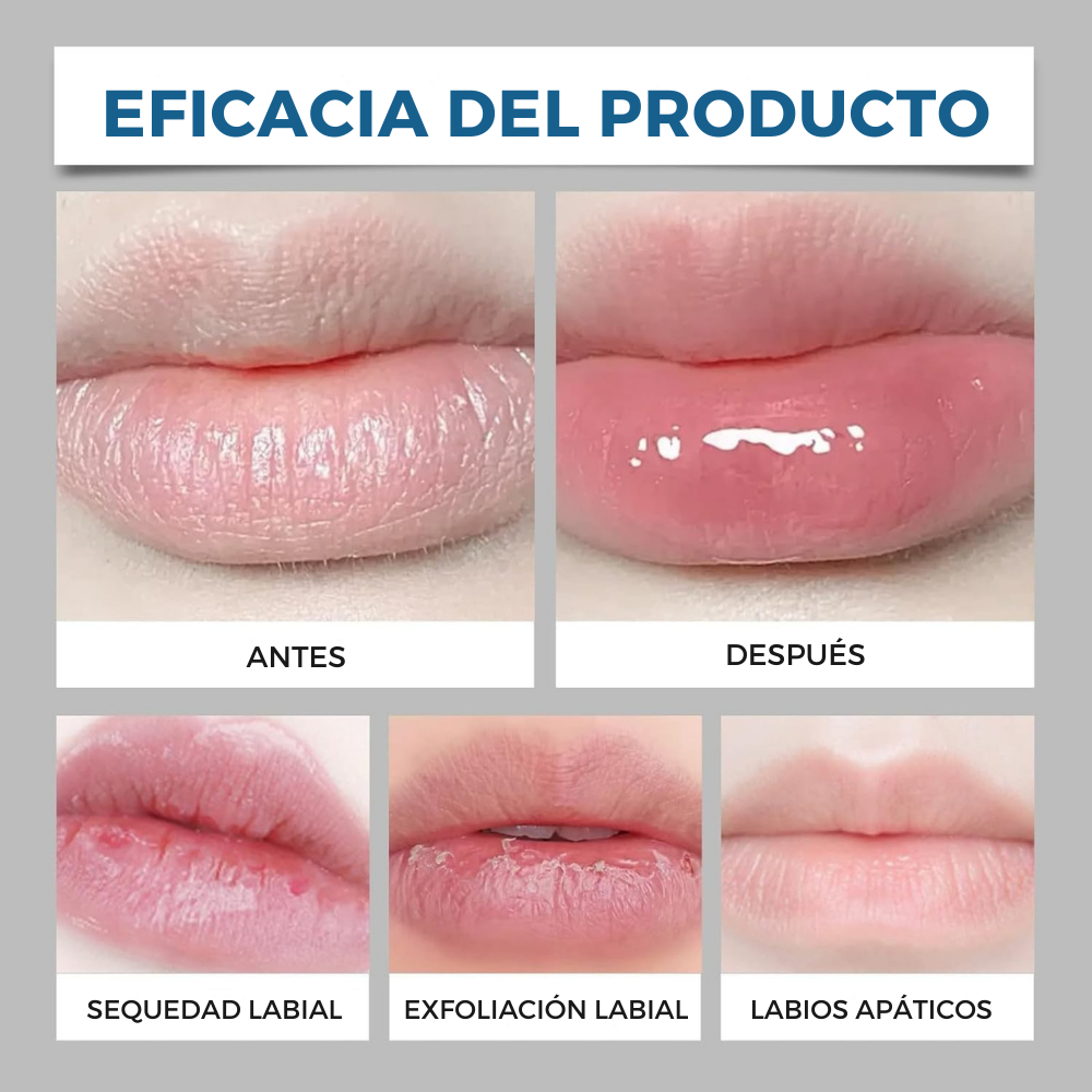 LabiosClaros™ – Crema Reductora de Manchitas