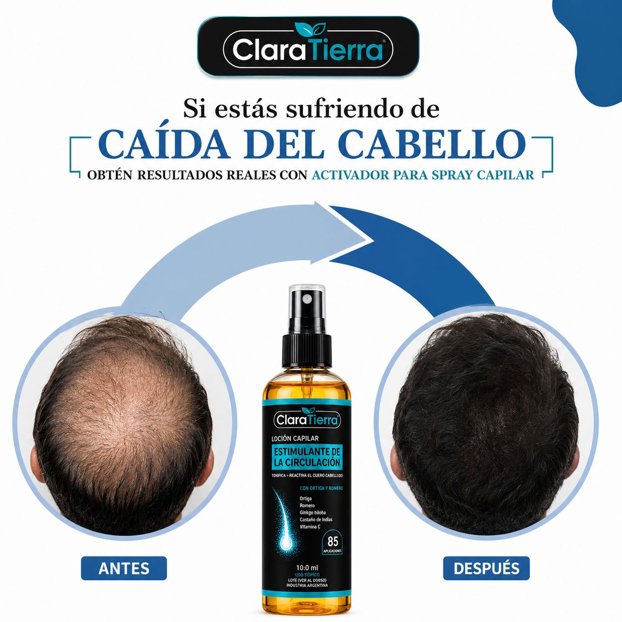 Activador para Spray Capilar – Cabello Más Fuerte, Denso y Saludable Desde la Raíz