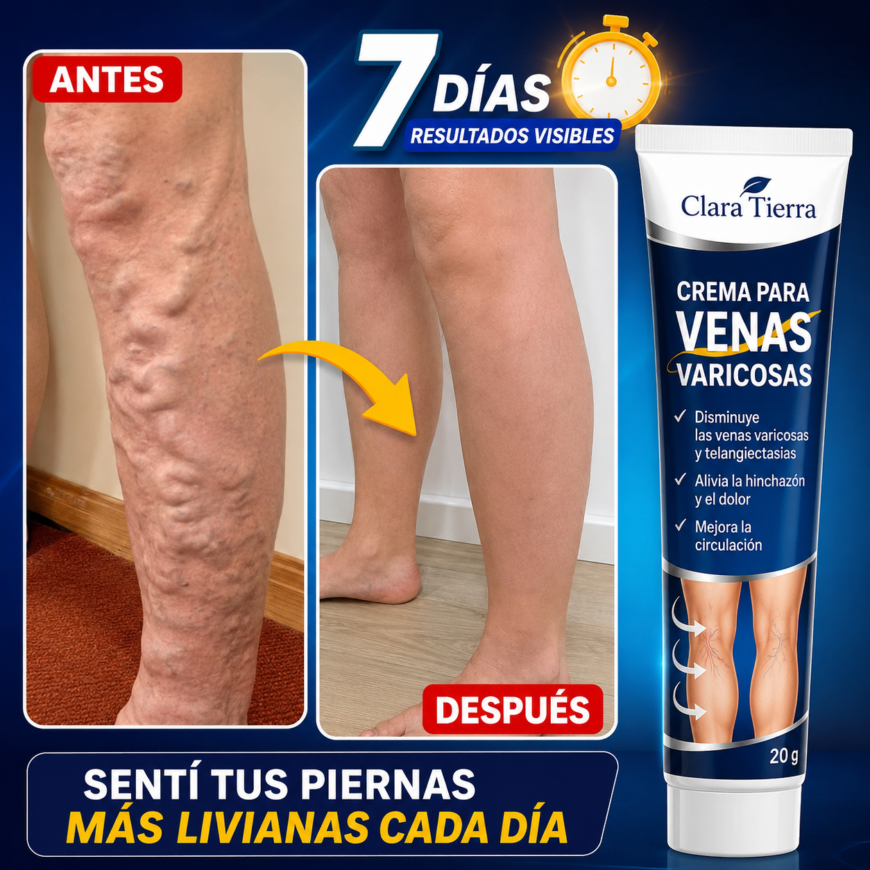 Crema para las Varices - Siente Tus Piernas Más Ligeras, Frescas y Cómodas Cada Día (Oferta 2x1)
