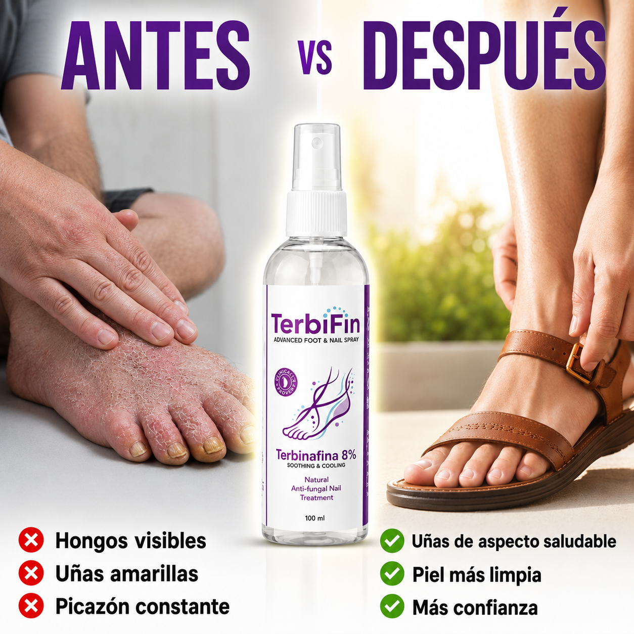 TerbiFin Advanced Foot & Nail Spray - Pies saludables. Confianza en cada paso.