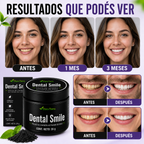 Polvo Dental Smile - una sonrisa más blanca, fresca y segura desde casa