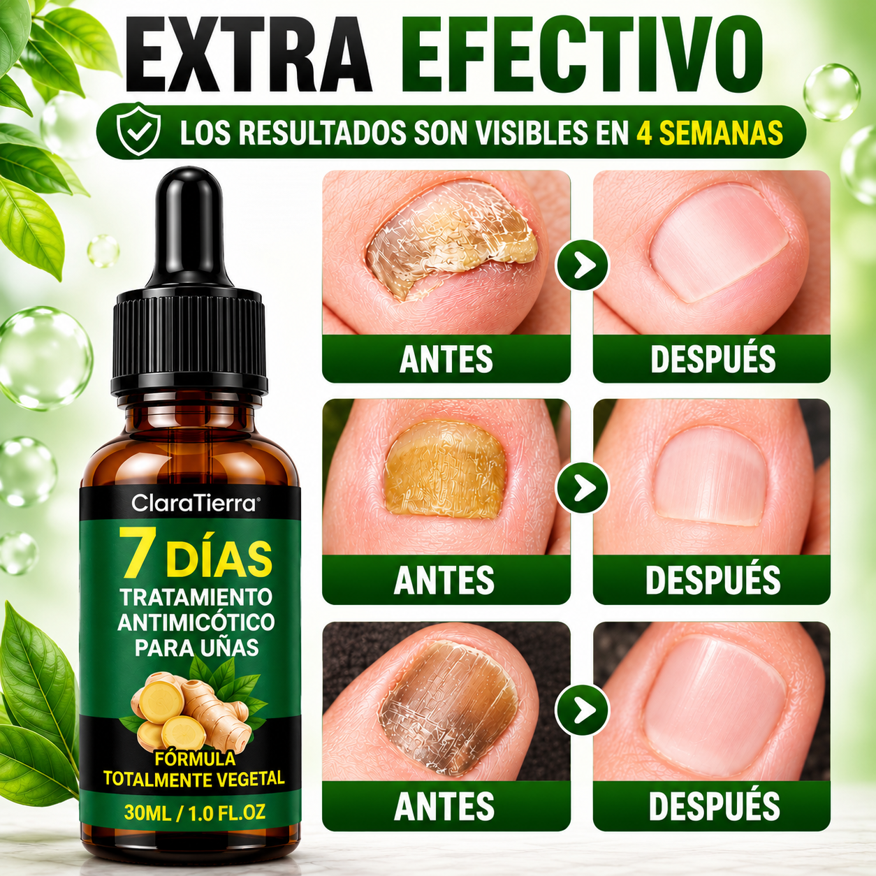 NailCure - Elimina los Hongos en las Uñas y Recupera Uñas Sanas y Hermosas Desde la Raíz