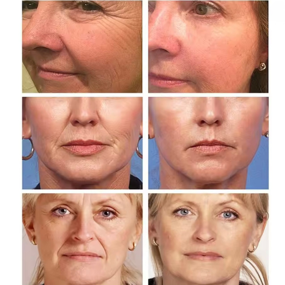 RejuveNatura Crema Super Resurfacing