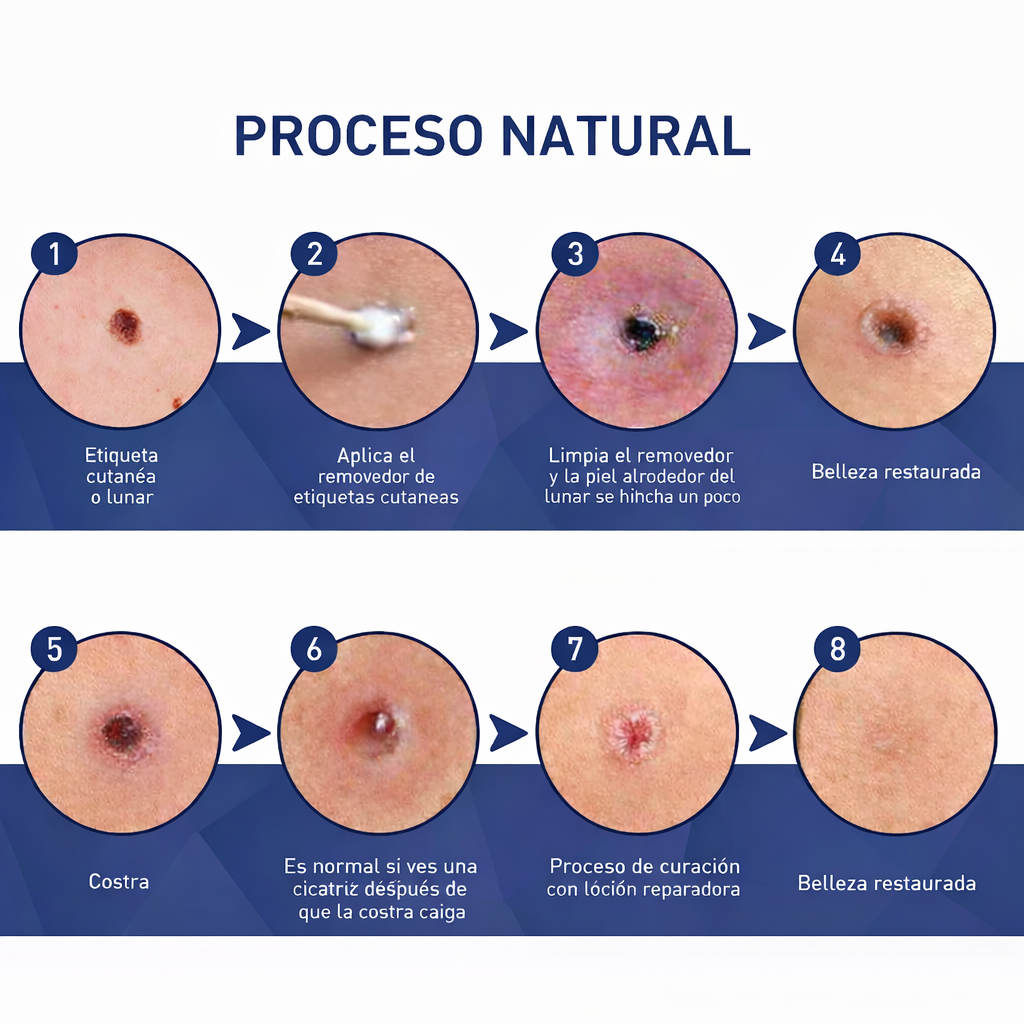 Gel para eliminar verrugas Verruxa: tratamiento avanzado para una piel limpia y sana.
