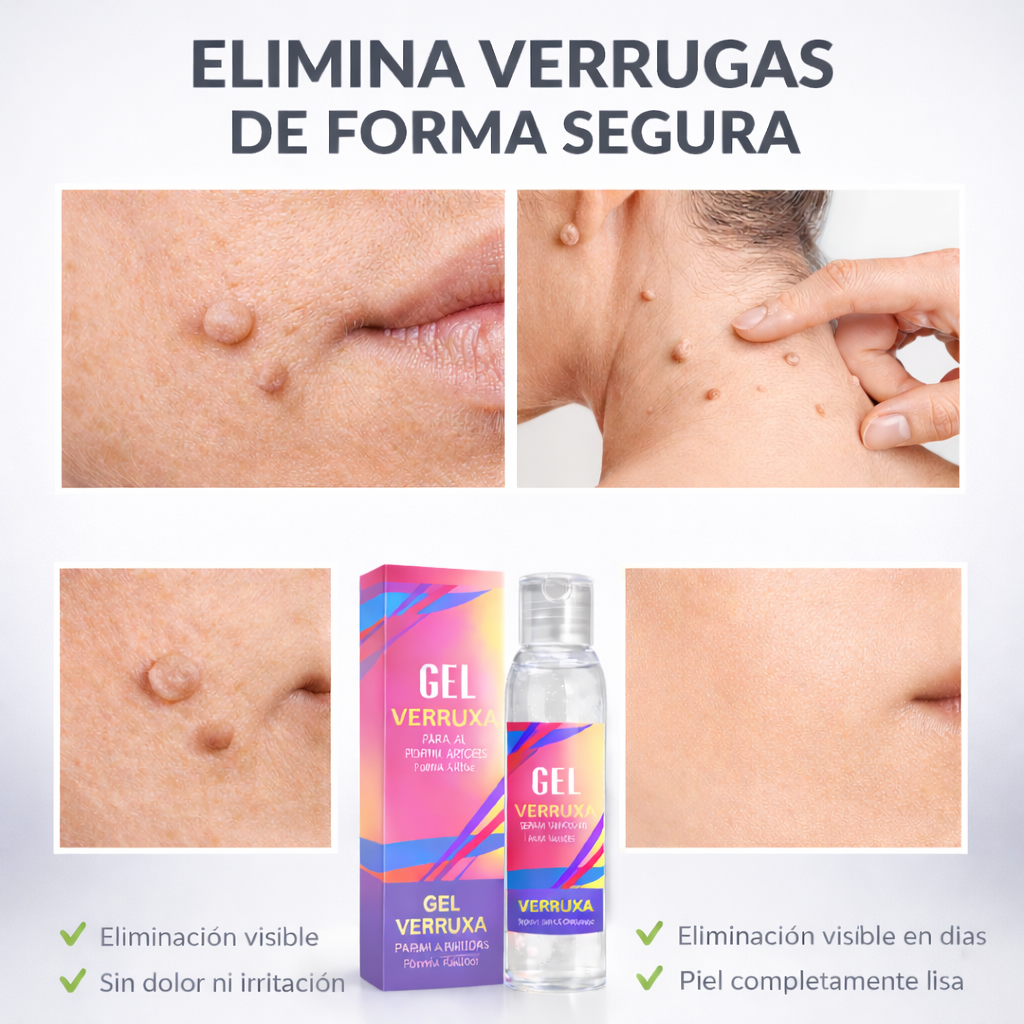 Gel para eliminar verrugas Verruxa: tratamiento avanzado para una piel limpia y sana.