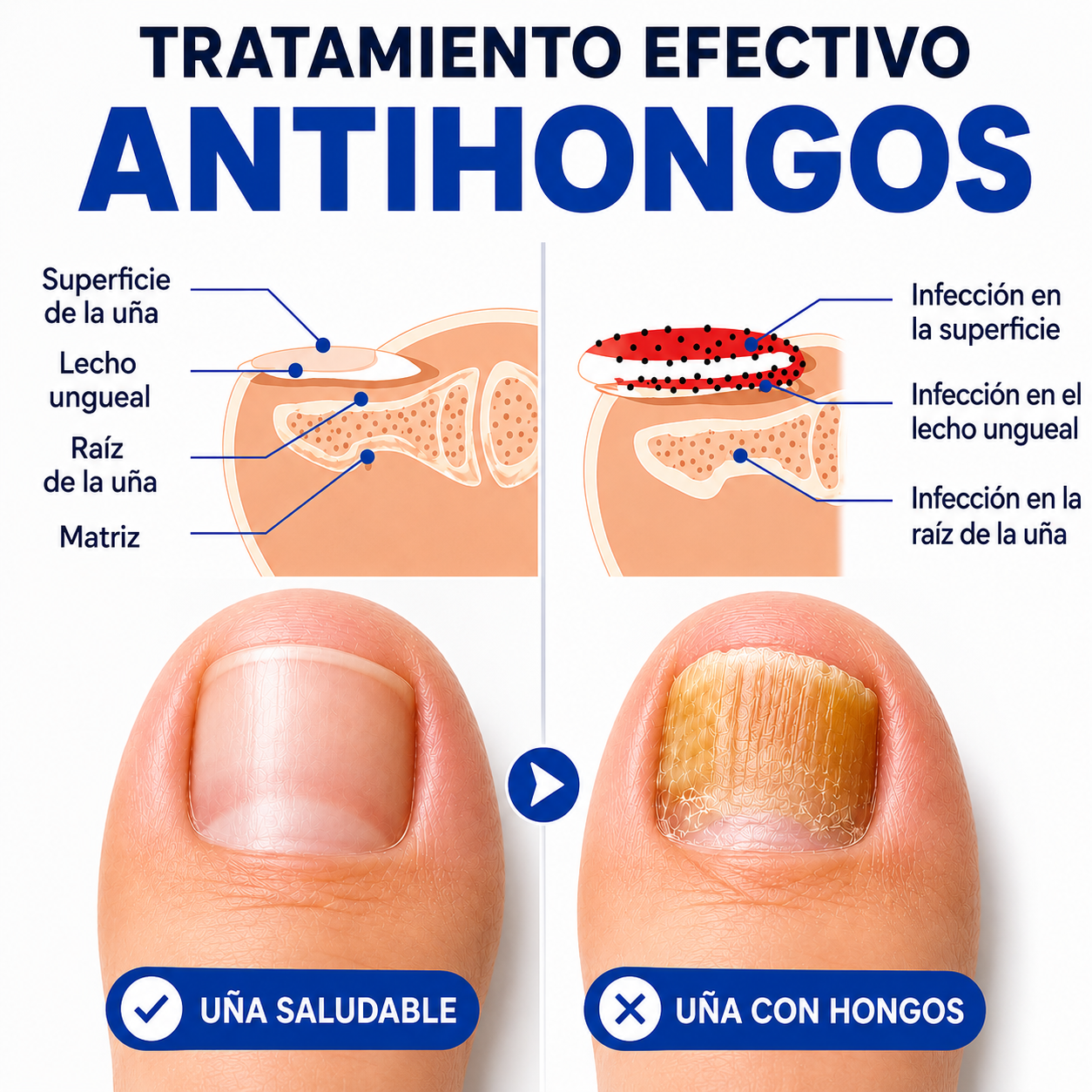Fórmula Anti-Hongos – Uñas Renovadas y de Aspecto Saludable