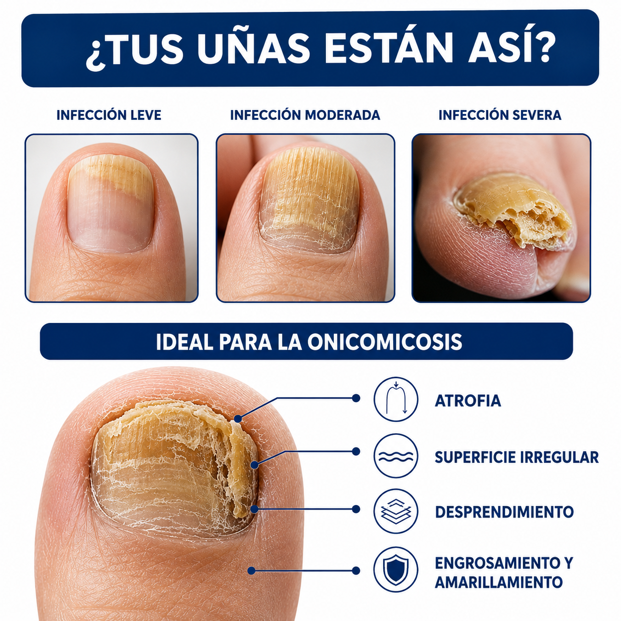 Fórmula Anti-Hongos – Uñas Renovadas y de Aspecto Saludable