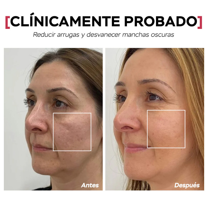 Seyoul 21 días suero