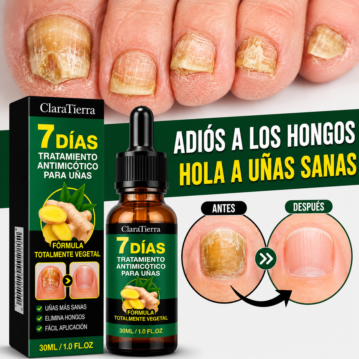 NailCure - Elimina los Hongos en las Uñas y Recupera Uñas Sanas y Hermosas Desde la Raíz