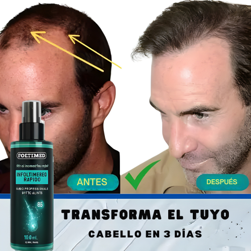 Foltimed – Revitaliza el cabello de forma natural para un cabello más grueso y saludable