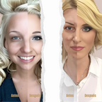 BASE LÍQUIDA VITAMIN C