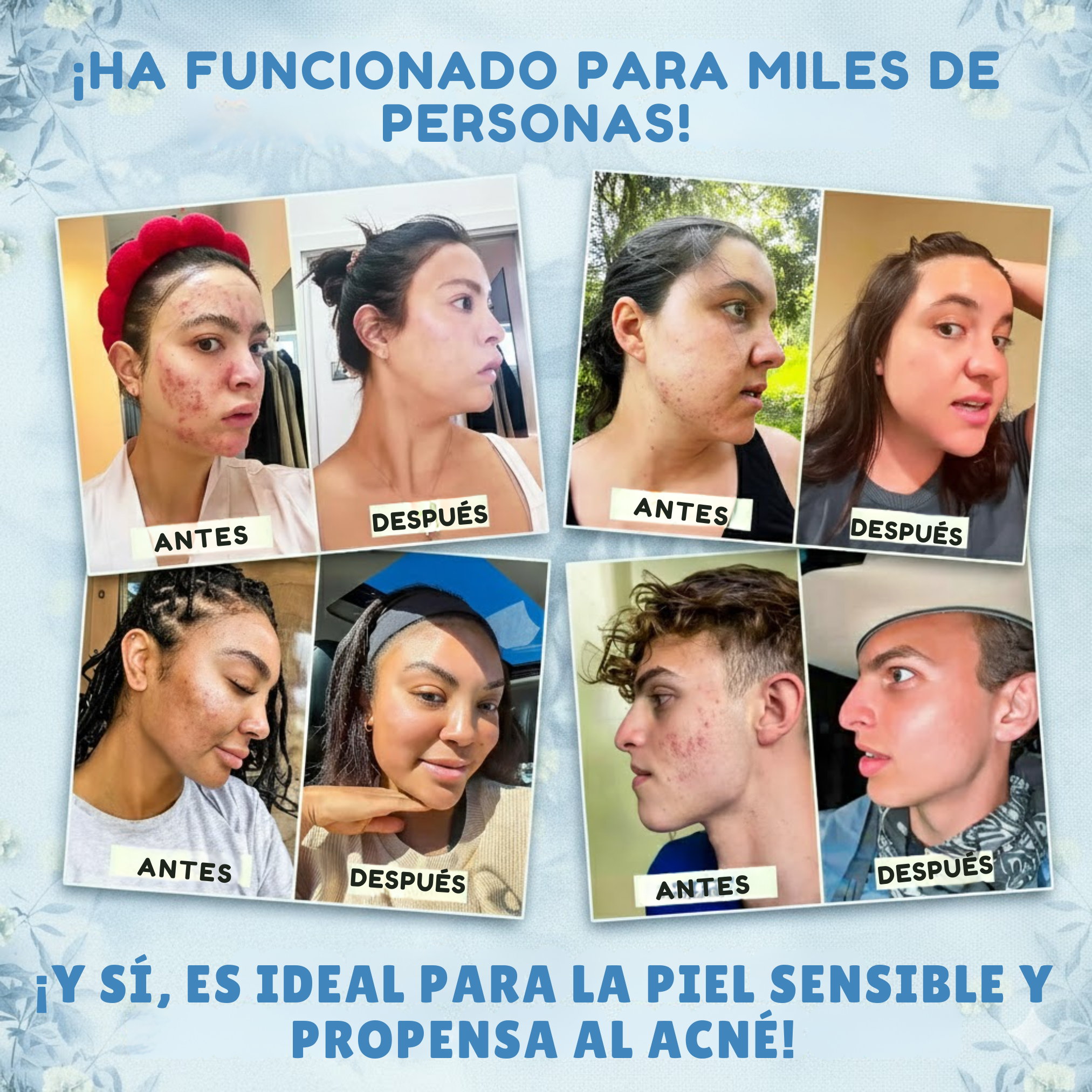 DermaLuz - ¡¡Reduce arrugas. Elimina acné. Mejora tu piel!!