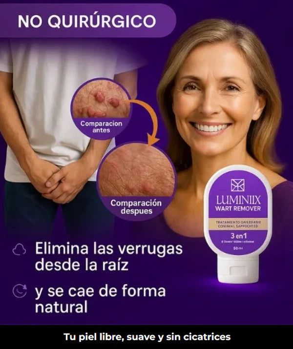 Luminiix – Eliminador natural de verrugas para una piel suave y limpia