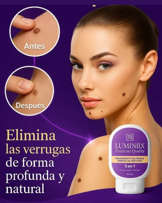Luminiix – Eliminador natural de verrugas para una piel suave y limpia
