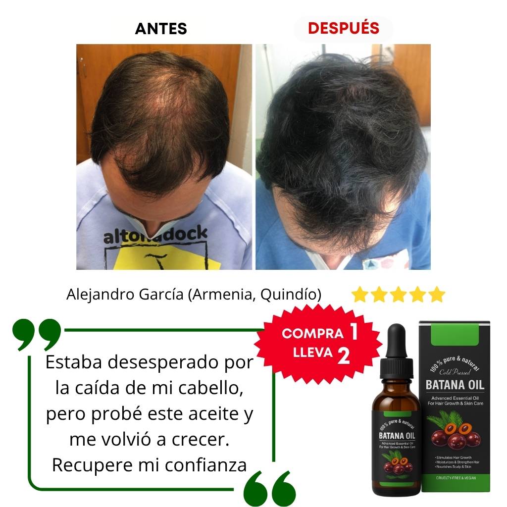 Aceite Batana Original – Tratamiento Natural para el Crecimiento del Cabello
