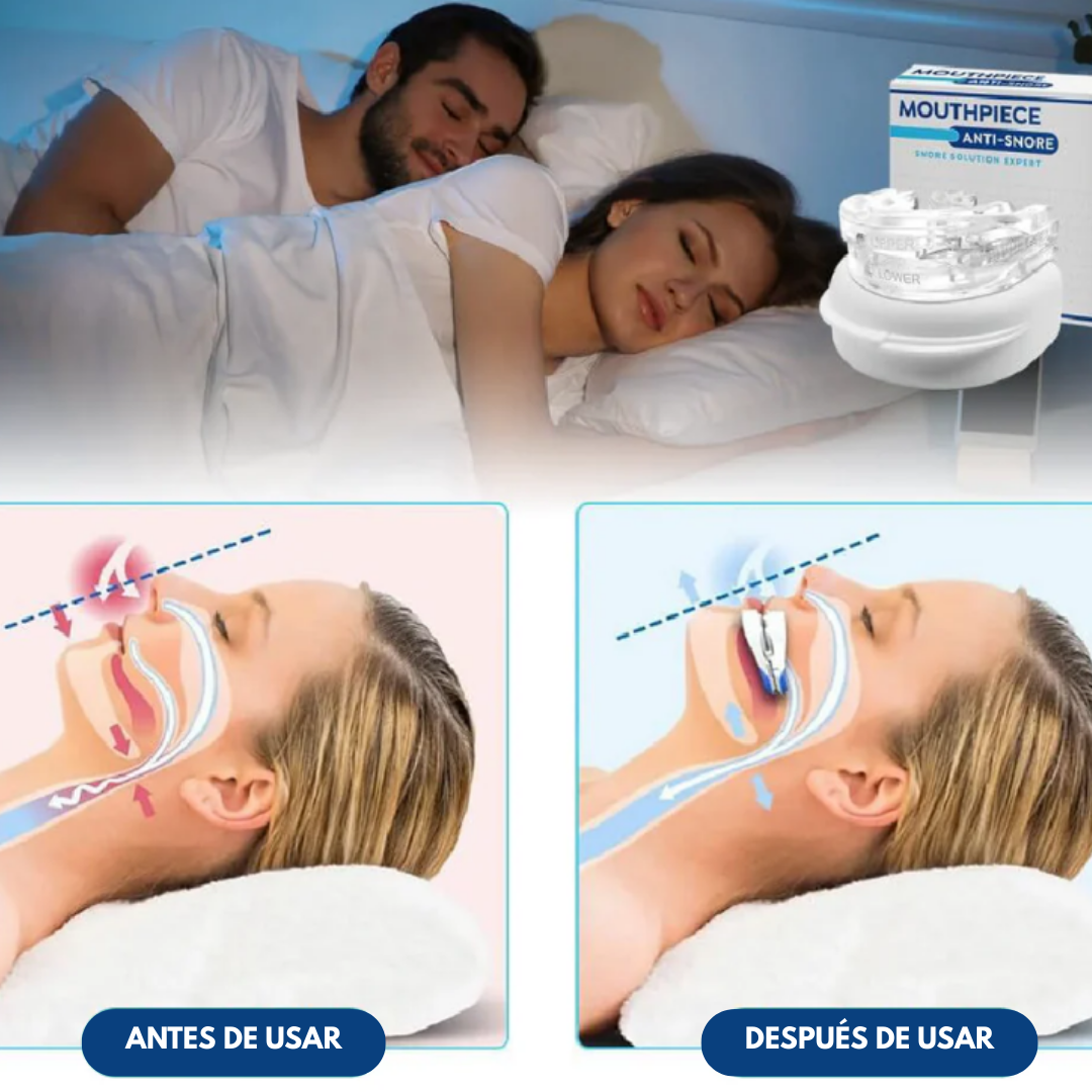 Dispositivo Oral Antironquidos