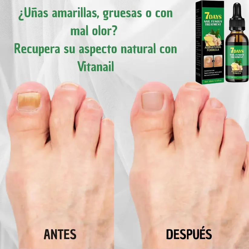 Clara‑Pure™ – Esencia Antihongos para Uñas