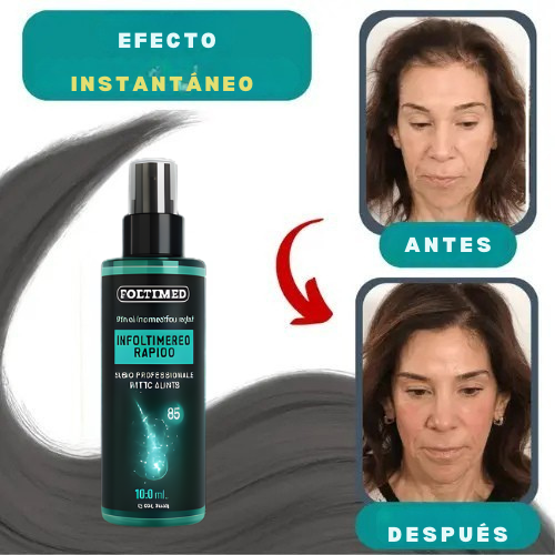 Foltimed – Revitaliza el cabello de forma natural para un cabello más grueso y saludable