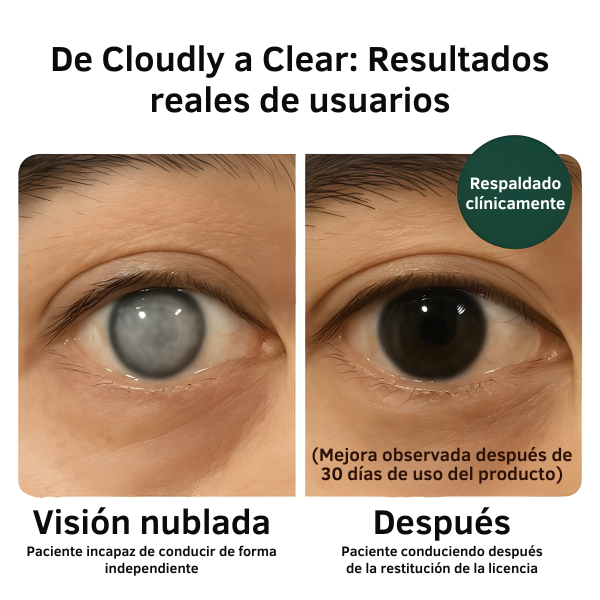 Zooone Protección de la visión