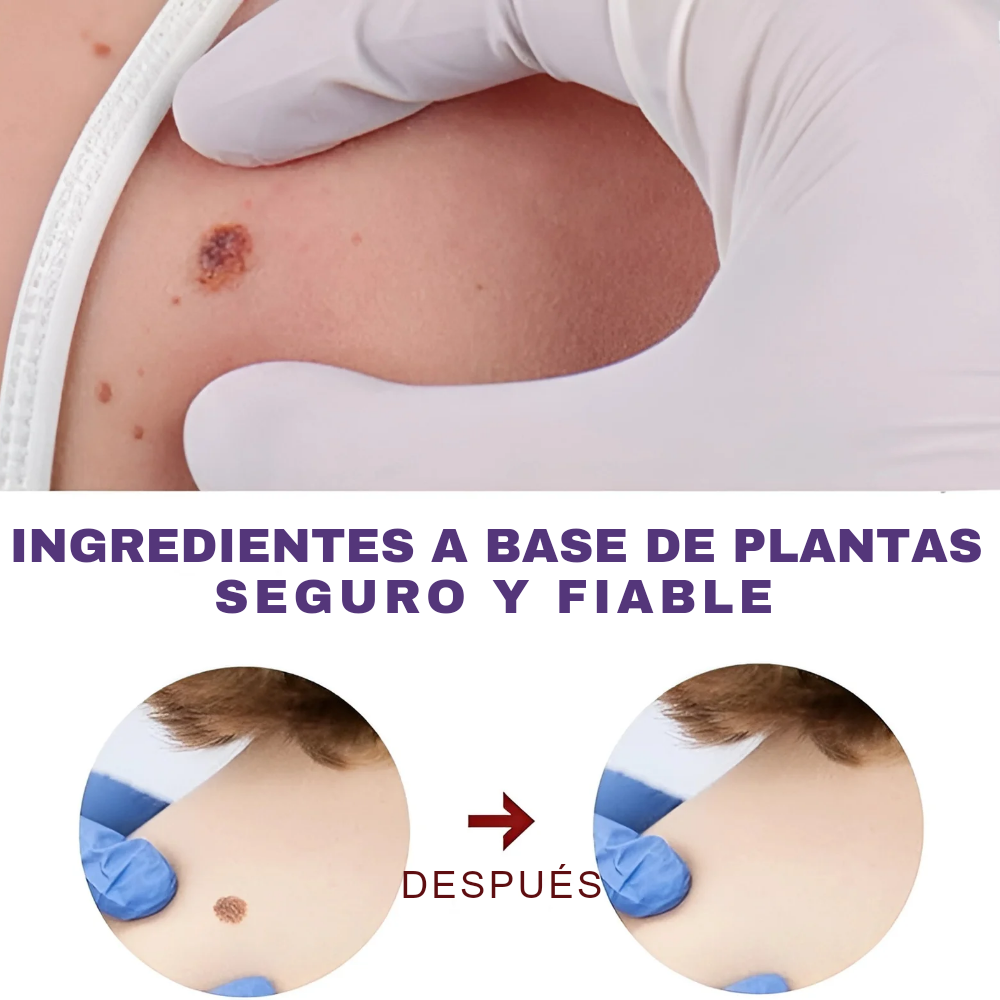 Luminiix Eliminador de Verrugas